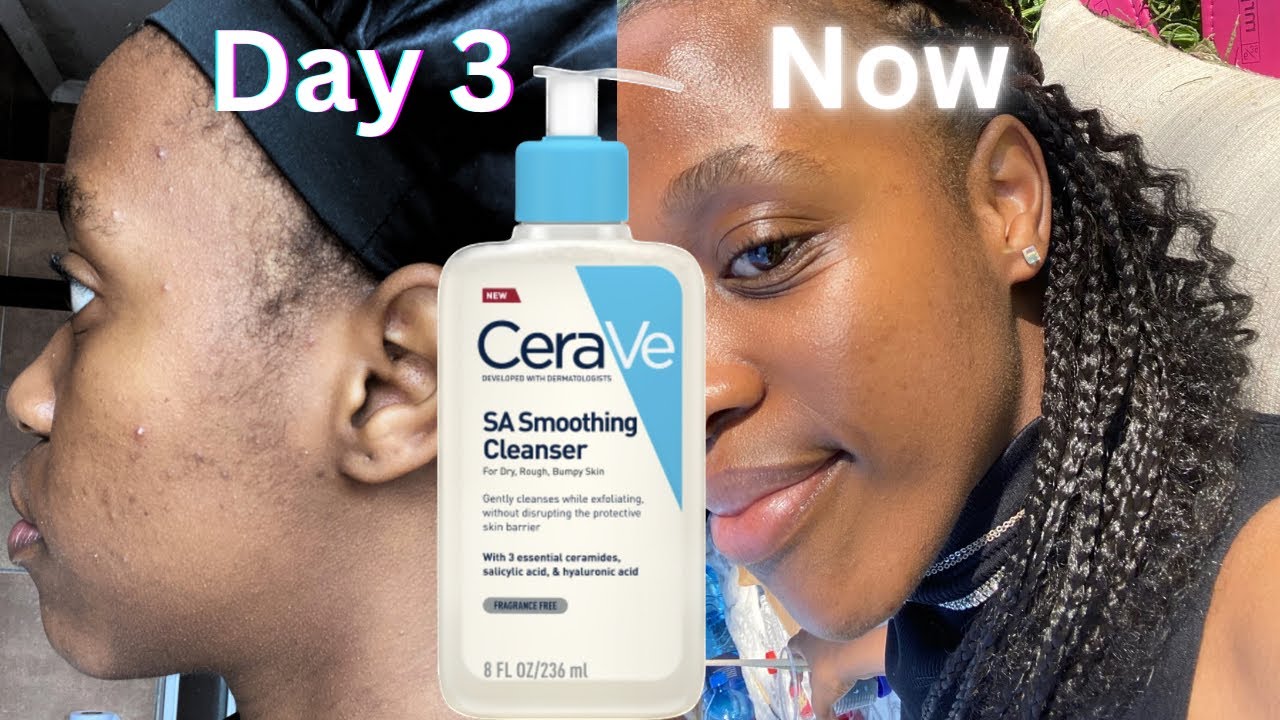 CeraVe SA Smoothing Cleanser: Pembersih Wajah untuk Kulit Halus dan Sehat